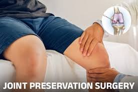 Preservation Surgery